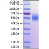 SDS-PAGE - Recombinant Human MICA Protein (C-terminal His Tag) (A331059) - Antibodies.com