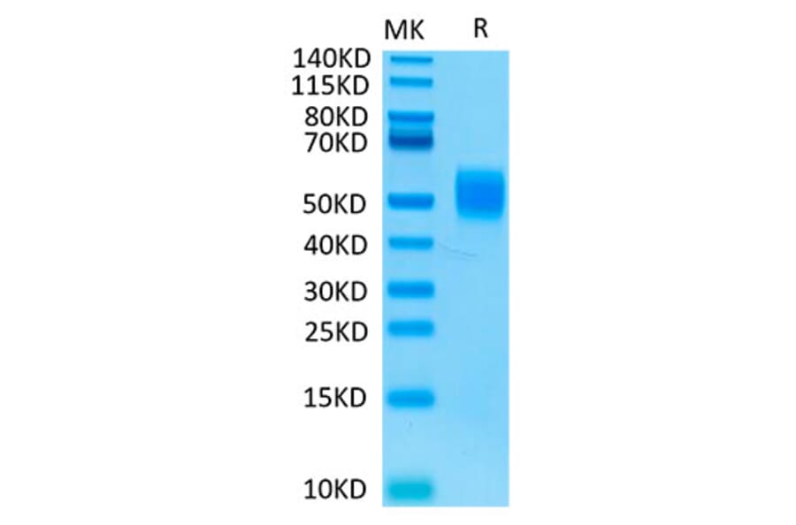 Tris-Bis PAGE - Recombinant Human MICB Protein (Biotin) (C-terminal His and Avi Tag) (A331060) - Antibodies.com