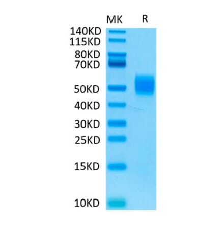 Tris-Bis PAGE - Recombinant Human MICB Protein (Biotin) (C-terminal His and Avi Tag) (A331060) - Antibodies.com