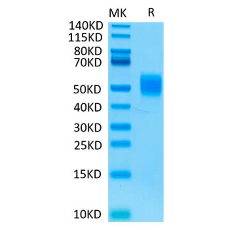 Tris-Bis PAGE - Recombinant Human MICB Protein (Biotin) (C-terminal His and Avi Tag) (A331060) - Antibodies.com
