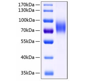 SDS-PAGE - Recombinant Human MICB Protein (C-terminal Human Fc and His Tag) (A331061) - Antibodies.com