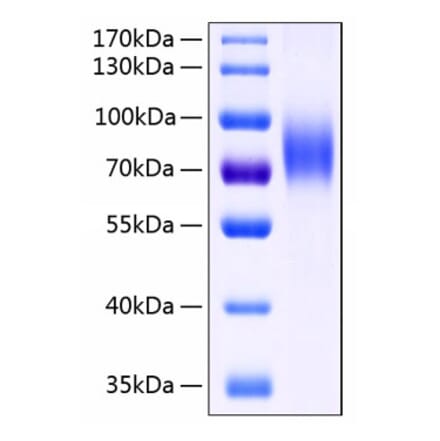 SDS-PAGE - Recombinant Human MICB Protein (C-terminal Human Fc and His Tag) (A331061) - Antibodies.com