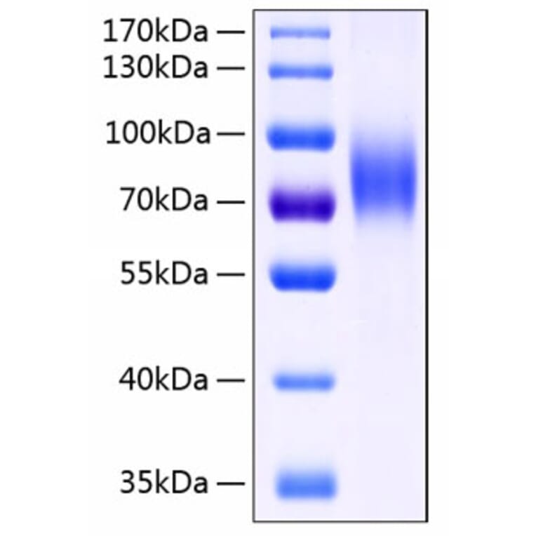 SDS-PAGE - Recombinant Human MICB Protein (C-terminal Human Fc and His Tag) (A331061) - Antibodies.com