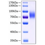 SDS-PAGE - Recombinant Human MICB Protein (C-terminal Human Fc and His Tag) (A331061) - Antibodies.com