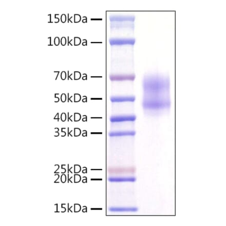 SDS-PAGE - Recombinant Human MITF Protein (N-terminal Rabbit Fc Tag) (A331064) - Antibodies.com