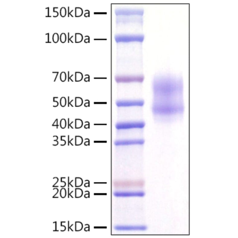 SDS-PAGE - Recombinant Human MITF Protein (N-terminal Rabbit Fc Tag) (A331064) - Antibodies.com
