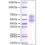 SDS-PAGE - Recombinant Human MITF Protein (N-terminal Rabbit Fc Tag) (A331064) - Antibodies.com