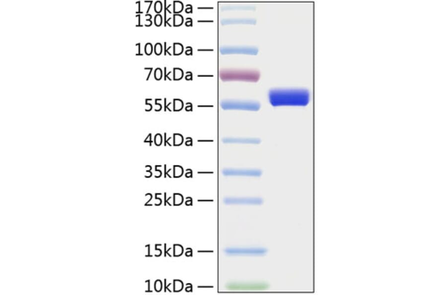 SDS-PAGE - Recombinant Human MMP1 Protein (C-terminal His Tag) (A331066) - Antibodies.com