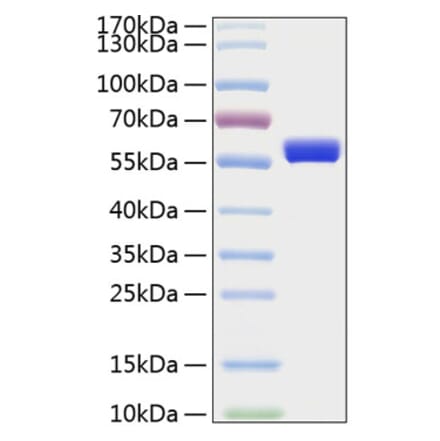 SDS-PAGE - Recombinant Human MMP1 Protein (C-terminal His Tag) (A331066) - Antibodies.com