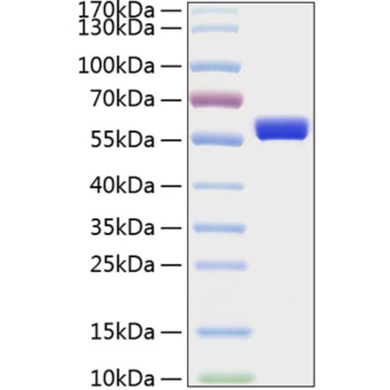 SDS-PAGE - Recombinant Human MMP1 Protein (C-terminal His Tag) (A331066) - Antibodies.com
