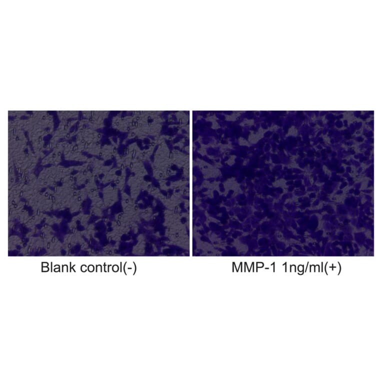 Cell Migration Assay - Recombinant Human MMP1 Protein (C-terminal His Tag) (A331066) - Antibodies.com