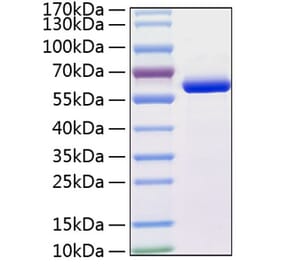 SDS-PAGE - Recombinant Human MMP13 Protein (C-terminal His Tag) (A331067) - Antibodies.com