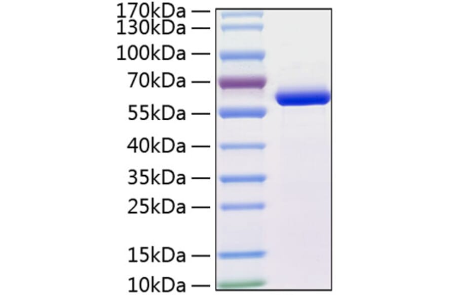 SDS-PAGE - Recombinant Human MMP13 Protein (C-terminal His Tag) (A331067) - Antibodies.com