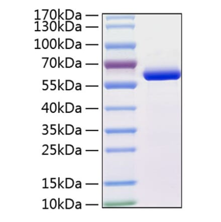 SDS-PAGE - Recombinant Human MMP13 Protein (C-terminal His Tag) (A331067) - Antibodies.com