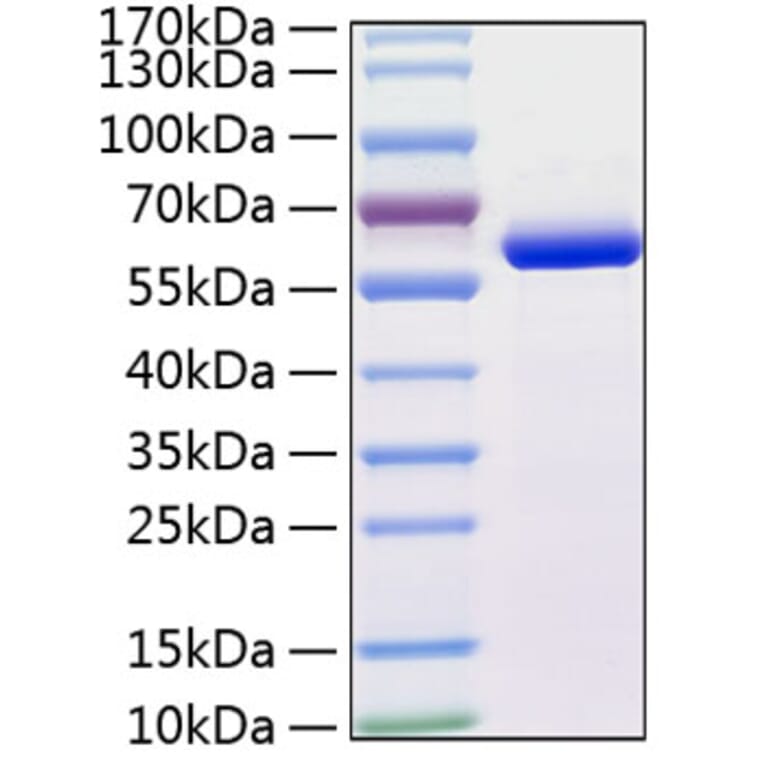 SDS-PAGE - Recombinant Human MMP13 Protein (C-terminal His Tag) (A331067) - Antibodies.com