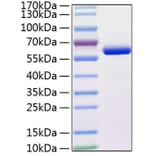 SDS-PAGE - Recombinant Human MMP13 Protein (C-terminal His Tag) (A331067) - Antibodies.com