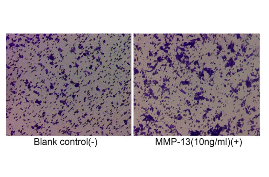 Cell Migration Assay - Recombinant Human MMP13 Protein (C-terminal His Tag) (A331067) - Antibodies.com
