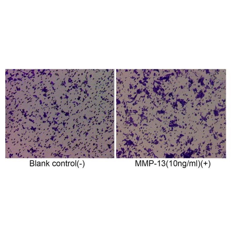 Cell Migration Assay - Recombinant Human MMP13 Protein (C-terminal His Tag) (A331067) - Antibodies.com