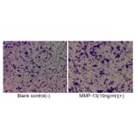 Cell Migration Assay - Recombinant Human MMP13 Protein (C-terminal His Tag) (A331067) - Antibodies.com