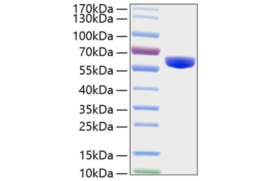SDS-PAGE - Recombinant Human MMP3 Protein (C-terminal His Tag) (A331068) - Antibodies.com