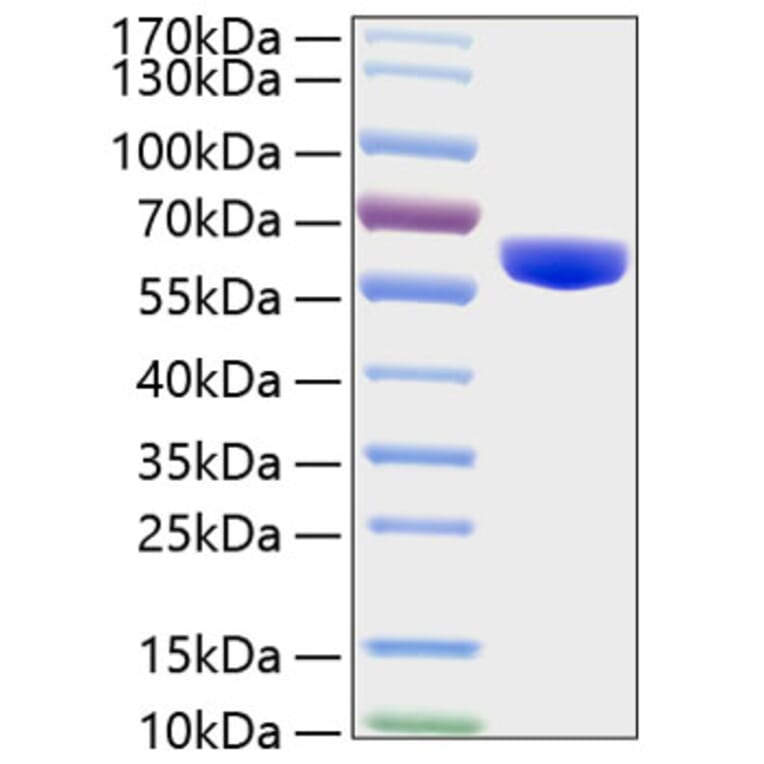 SDS-PAGE - Recombinant Human MMP3 Protein (C-terminal His Tag) (A331068) - Antibodies.com