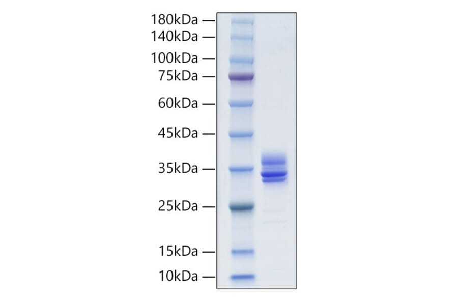 SDS-PAGE - Recombinant Human MMP7 Protein (C-terminal His Tag) (A331069) - Antibodies.com