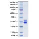 SDS-PAGE - Recombinant Human MMP7 Protein (C-terminal His Tag) (A331069) - Antibodies.com