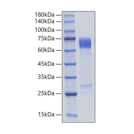 SDS-PAGE - Recombinant Human MMP8 Protein (C-terminal His Tag) (A331070) - Antibodies.com