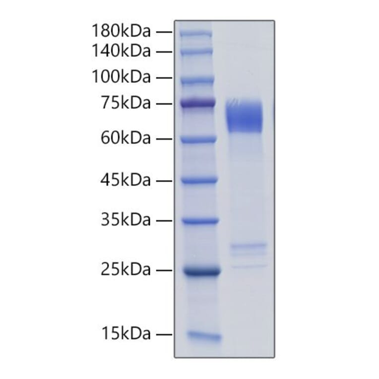 SDS-PAGE - Recombinant Human MMP8 Protein (C-terminal His Tag) (A331070) - Antibodies.com