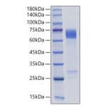 SDS-PAGE - Recombinant Human MMP8 Protein (C-terminal His Tag) (A331070) - Antibodies.com