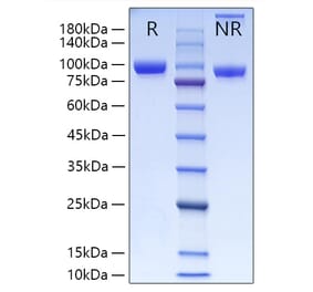 SDS-PAGE - Recombinant Human MMP9 Protein (C-terminal His Tag) (A331071) - Antibodies.com