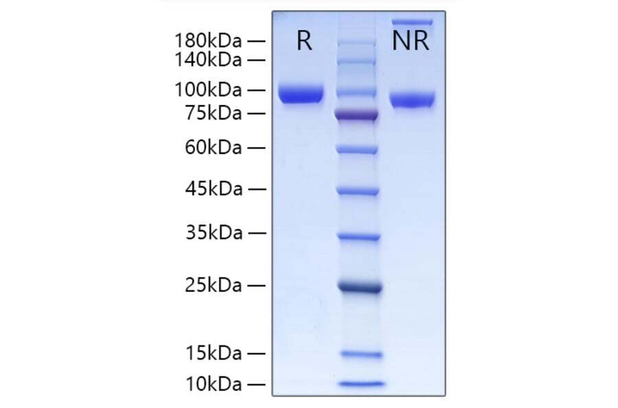 SDS-PAGE - Recombinant Human MMP9 Protein (C-terminal His Tag) (A331071) - Antibodies.com
