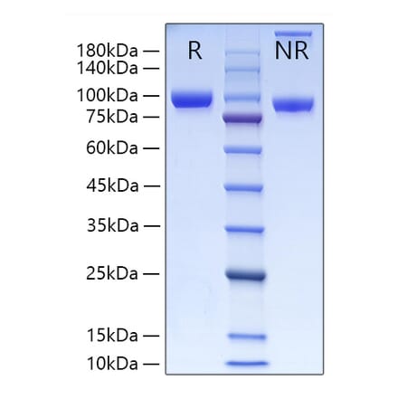 SDS-PAGE - Recombinant Human MMP9 Protein (C-terminal His Tag) (A331071) - Antibodies.com