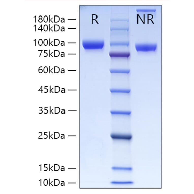 SDS-PAGE - Recombinant Human MMP9 Protein (C-terminal His Tag) (A331071) - Antibodies.com