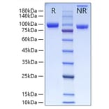 SDS-PAGE - Recombinant Human MMP9 Protein (C-terminal His Tag) (A331071) - Antibodies.com