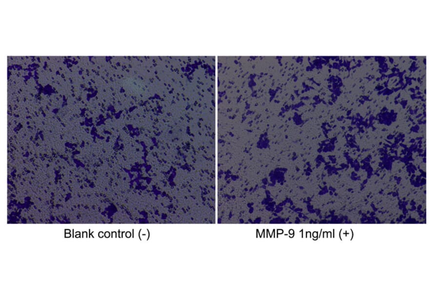 Cell Migration Assay - Recombinant Human MMP9 Protein (C-terminal His Tag) (A331071) - Antibodies.com