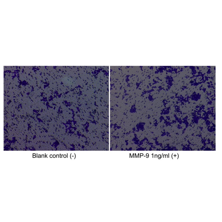 Cell Migration Assay - Recombinant Human MMP9 Protein (C-terminal His Tag) (A331071) - Antibodies.com