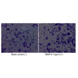 Cell Migration Assay - Recombinant Human MMP9 Protein (C-terminal His Tag) (A331071) - Antibodies.com