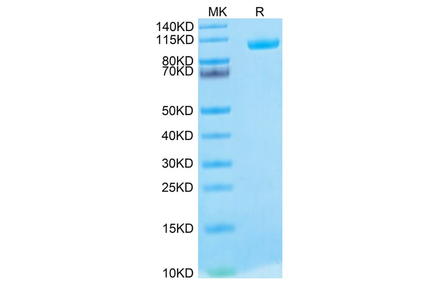 Tris-Bis PAGE - Recombinant Human MMP9 Protein (Biotin) (C-terminal His and Avi Tag) (A331072) - Antibodies.com