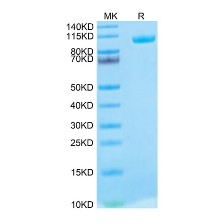 Tris-Bis PAGE - Recombinant Human MMP9 Protein (Biotin) (C-terminal His and Avi Tag) (A331072) - Antibodies.com