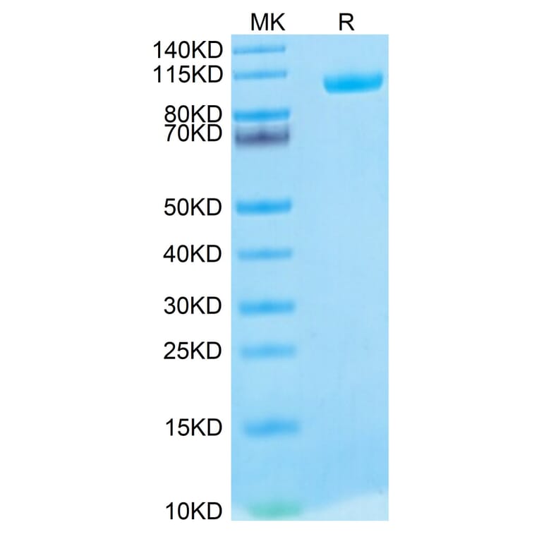 Tris-Bis PAGE - Recombinant Human MMP9 Protein (Biotin) (C-terminal His and Avi Tag) (A331072) - Antibodies.com