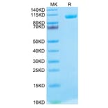 Tris-Bis PAGE - Recombinant Human MMP9 Protein (Biotin) (C-terminal His and Avi Tag) (A331072) - Antibodies.com