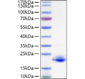 SDS-PAGE - Recombinant Human MOG Protein (C-terminal His Tag) (A331073) - Antibodies.com