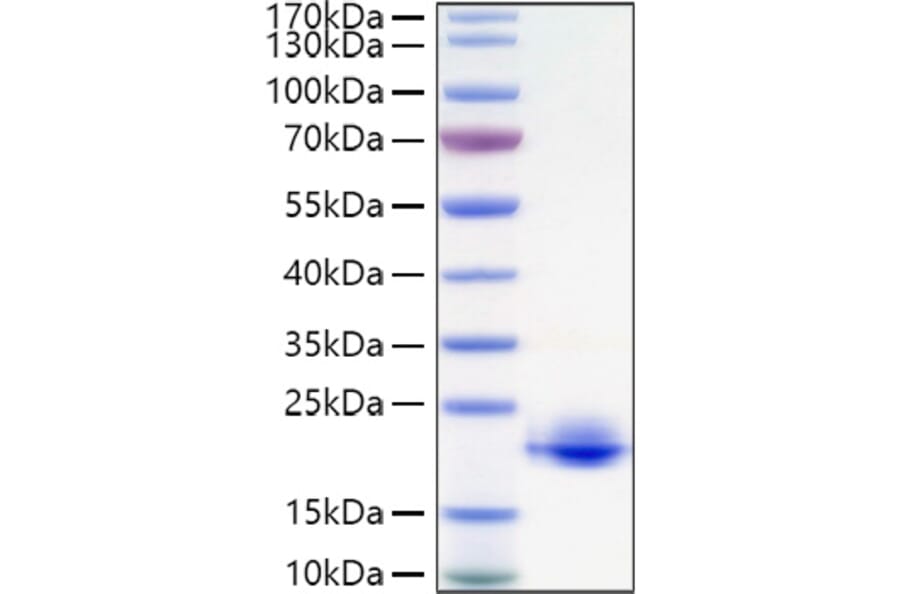 SDS-PAGE - Recombinant Human MOG Protein (C-terminal His Tag) (A331073) - Antibodies.com