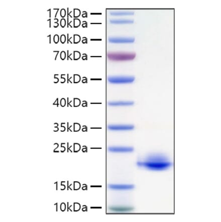 SDS-PAGE - Recombinant Human MOG Protein (C-terminal His Tag) (A331073) - Antibodies.com