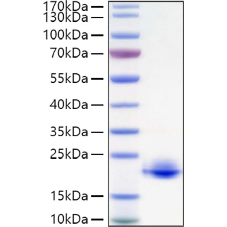 SDS-PAGE - Recombinant Human MOG Protein (C-terminal His Tag) (A331073) - Antibodies.com