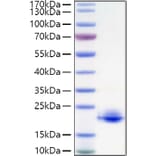 SDS-PAGE - Recombinant Human MOG Protein (C-terminal His Tag) (A331073) - Antibodies.com