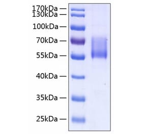 SDS-PAGE - Recombinant Human MUC1 Protein (C-terminal Human Fc and His Tag) (A331074) - Antibodies.com