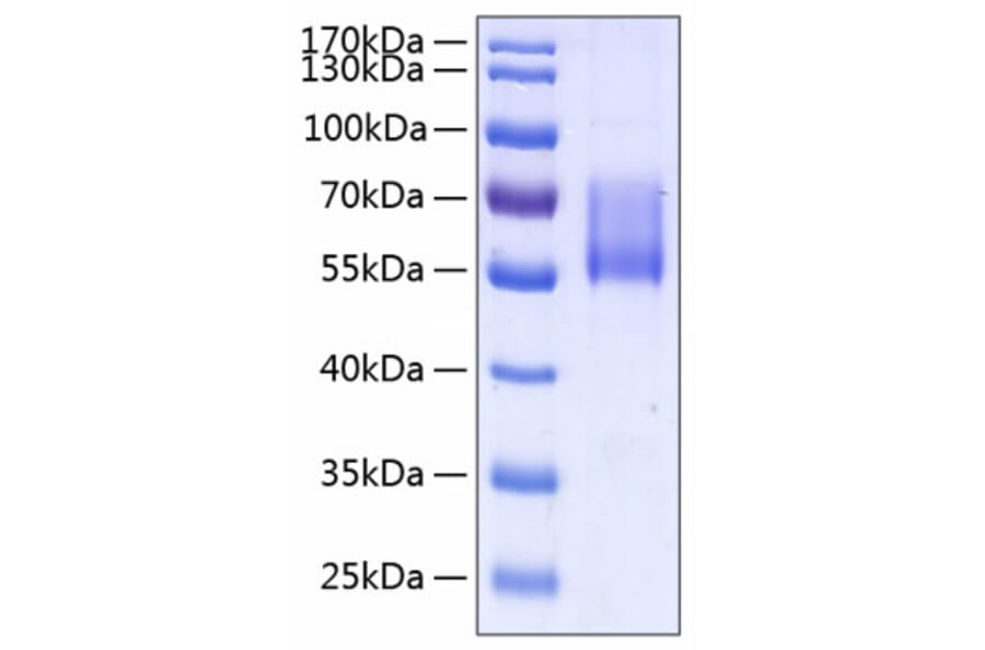 SDS-PAGE - Recombinant Human MUC1 Protein (C-terminal Human Fc and His Tag) (A331074) - Antibodies.com