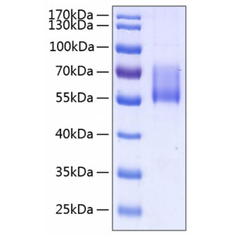 SDS-PAGE - Recombinant Human MUC1 Protein (C-terminal Human Fc and His Tag) (A331074) - Antibodies.com